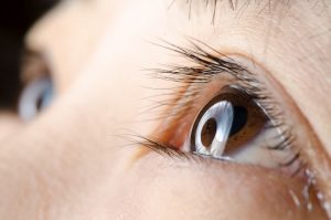 Lasik Surgery
